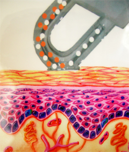 Microdermabrasion Illustrasion